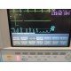 HP Viridia 24C (NBP SpO2 EKG T CO & Print) Monitor W/ Rack Modules & Leads~14024