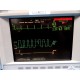 HP V24C (NBP SpO2 EKG Temp Print) Patient Monitor W/ Rack Modules & Leads~14023