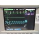 HP V24C (NBP SpO2 EKG Temp Print) Patient Monitor W/ Rack Modules & Leads~14022