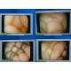 Olympus ACMI Laparoscopy Sys W/ OTV-6S CCU, OTV-S6H, CLV-S40 & 24" Display~21987