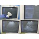 Siemens Sonoline Antares Ultrasound W/ EC9-4, CH4-1 & VFX13-5 Probes ~ 19428