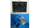 MEDRAD Veris 3010459 ECG Module W/ 3 Leads & Remote Blue/Grey Cable ~ 23316