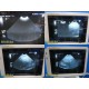 GE MTZ 6.5 P9603MB Convex Array Endocavity Ultrasound Transducer Probe ~ 23755
