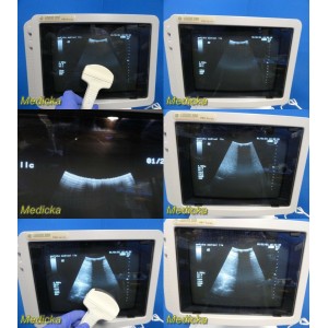 https://www.themedicka.com/9929-110193-thickbox/2003-ge-logiq-200-pro-series-ultrasound-w-3cb-convex-mtz-65mhz-probe-23768.jpg